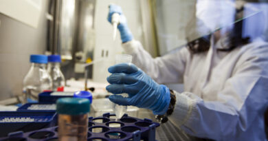 HIV araştırma ağları laboratuvar klinik deney çalışması