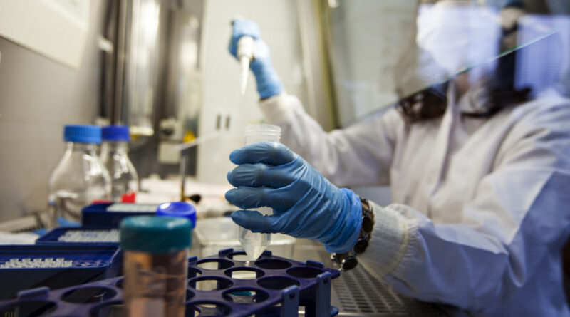 HIV araştırma ağları laboratuvar klinik deney çalışması